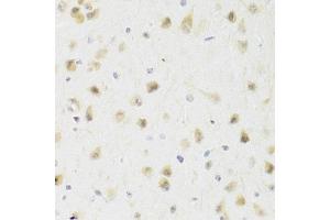 Immunohistochemistry of paraffin-embedded rat brain using PAWR Antibody (ABIN1874043) at dilution of 1:100 (40x lens). (PAWR 抗体)