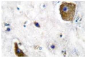Image no. 1 for anti-Glutamate Decarboxylase 1 (Brain, 67kDa) (GAD1) antibody (ABIN265428) (GAD 抗体)
