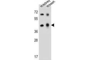 Western Blotting (WB) image for anti-Adenosine Deaminase-Like Protein (ADAL) antibody (ABIN2997438) (ADAL 抗体)