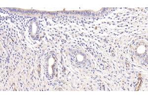 Immunohistochemistry (IHC) image for anti-Adiponectin (ADIPOQ) (AA 111-244) antibody (ABIN7427417)