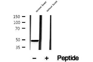 Western blot analysis of extracts of mouse heart tissue, using MMP28 antibody.