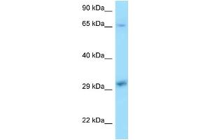 WB Suggested Anti-XPA Antibody Titration: 1. (XPA 抗体  (C-Term))