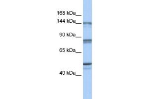 WB Suggested Anti-CSE1L Antibody Titration:  0. (Exportin 2 抗体  (N-Term))