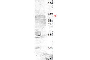 Western blot using NEDD4 polyclonal antibody  shows detection of a 115 kDa band corresponding to endogenous NEDD4 (arrowhead) in MDA-MB-435 cell lysates. (NEDD4 抗体  (Internal Region))