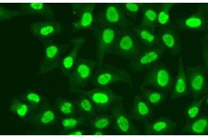 Immunofluorescence analysis of A549 cells using RFC1 Polyclonal Antibody (RFC1 抗体)