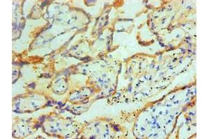 Immunohistochemical of paraffin-embedded Human placenta tissue using ABIN7166415 at dilution of 1:200. (Transglutaminase 2 抗体)