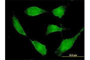Immunofluorescence of purified MaxPab antibody to BSG on HeLa cell. (CD147 抗体  (AA 1-269))