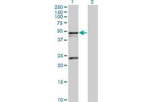 Western Blot analysis of PSRC1 expression in transfected 293T cell line by PSRC1 MaxPab polyclonal antibody. (PSRC1 抗体  (AA 1-363))