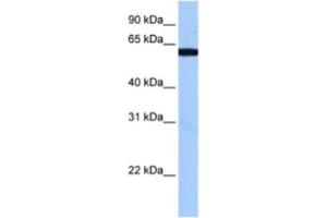 Western Blotting (WB) image for anti-RNA Binding Motif Protein 14 (RBM14) antibody (ABIN2462204) (RBM14 抗体)