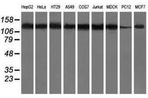 Image no. 2 for anti-Histone Deacetylase 6 (HDAC6) antibody (ABIN1498620) (HDAC6 抗体)