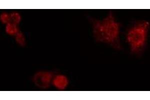 ABIN6272434 staining HuvEc by IF/ICC. (Splicing Factor 1 抗体  (N-Term))