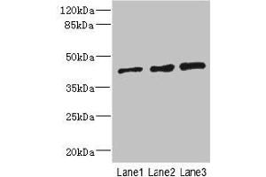 Western blot All lanes: ZNF24 antibody at 2. (ZNF24 抗体  (AA 169-368))