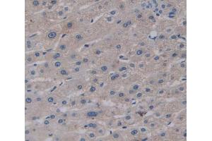 Used in DAB staining on fromalin fixed paraffin- embedded Kidney tissue (GGPS1 抗体  (AA 1-290))