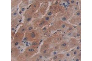 IHC-P analysis of Human Tissue, with DAB staining. (MT1 抗体  (AA 1-61))
