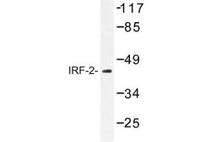 Image no. 1 for anti-Interferon Regulatory Factor 2 (IRF2) antibody (ABIN272167) (IRF2 抗体)