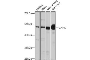 Western blot analysis of extracts of various cell lines, using GNAS antibody (ABIN6127959, ABIN6141213, ABIN6141214 and ABIN6221191) at 1:1000 dilution. (GNAS 抗体  (AA 1-394))