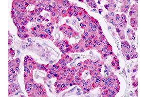 Human, Pancreas, Islets: Formalin-Fixed Paraffin-Embedded (FFPE) (LGR5 抗体  (N-Term))