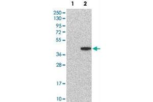 Western Blot analysis of Lane 1: negative control (vector only transfected HEK293T cell lysate) and Lane 2: over-expression lysate (co-expressed with a C-terminal myc-DDK tag in mammalian HEK293T cells) with ATP6AP2 polyclonal antibody .