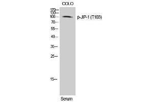 Western Blotting (WB) image for anti-Mitogen-Activated Protein Kinase 8 Interacting Protein 1 (MAPK8IP1) (pThr103) antibody (ABIN3179602) (MAPK8IP1 抗体  (pThr103))
