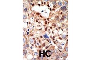 Immunohistochemistry (Paraffin-embedded Sections) (IHC (p)) image for anti-Promyelocytic Leukemia (PML) (AA 470-499), (Sumoylation Site) antibody (ABIN389073)