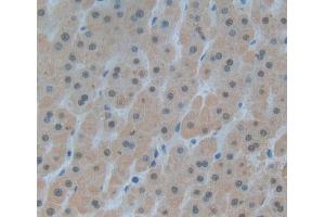 Used in DAB staining on fromalin fixed paraffin- embedded liver tissue (DKC1 抗体  (AA 298-465))