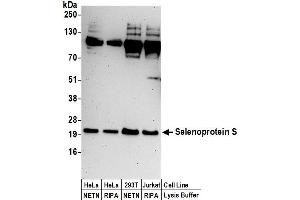 anti-Selenoprotein S (SELS) (AA 125-175) antibody