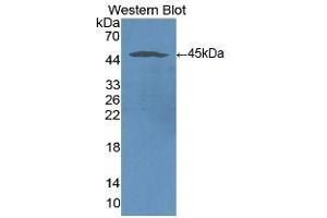 Detection of Recombinant ICAM1, Human using Monoclonal Antibody to Intercellular Adhesion Molecule 1 (ICAM1) (ICAM1 抗体  (AA 41-464))
