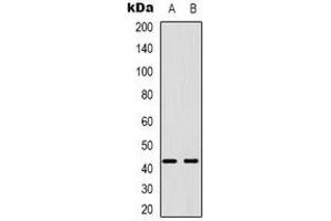 Western blot analysis of PABPC5 expression in U87MG (A), K562 (B) whole cell lysates. (PABPC5 抗体)