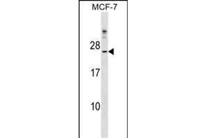 CYB5D1 Antibody (Center) (ABIN1538512 and ABIN2849260) western blot analysis in MCF-7 cell line lysates (35 μg/lane). (CYB5D1 抗体  (AA 59-86))