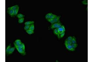 Immunofluorescence (IF) image for anti-Ankyrin Repeat, SAM and Basic Leucine Zipper Domain Containing 1 (ASZ1) (AA 1-200) antibody (ABIN7144247)