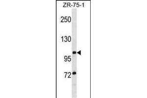 TTLL8 Antibody (N-term) (ABIN1539332 and ABIN2848514) western blot analysis in ZR-75-1 cell line lysates (35 μg/lane). (TTLL8 抗体  (N-Term))