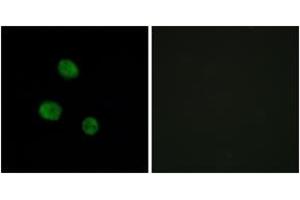 Immunofluorescence analysis of MCF7 cells, using hnRNP M Antibody.