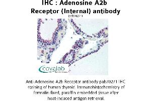 Image no. 2 for anti-Adenosine A2b Receptor (ADORA2B) (Internal Region) antibody (ABIN1731551) (Adenosine A2b Receptor 抗体  (Internal Region))