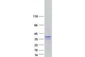 Western Blotting (WB) image for Basic Helix-Loop-Helix Family, Member A9 (BHLHA9) protein (Myc-DYKDDDDK Tag) (ABIN2715153)
