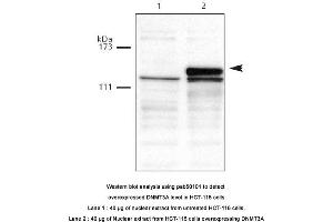 Image no. 1 for anti-Deoxyribonucleic Acid (DNA) (AA 10-118) antibody (ABIN363410) (DNA 抗体  (AA 10-118))