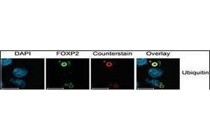 Characterization of FOXP2 Isoforms. (Ubiquitin 抗体  (AA 36-66))