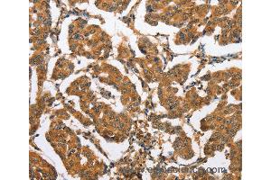 Immunohistochemistry of Human brain  using CXCL14 Polyclonal Antibody at dilution of 1:60 (CXCL14 抗体)