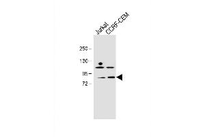 All lanes :PLK2 (SNK) Antibody (C-term) at 1:1000 dilution Lane 1: Jurkat whole cell lysate Lane 2: CCRF-CEM whole cell lysate Lysates/proteins at 20 μg per lane. (PLK2 抗体  (C-Term))