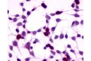 Anti-GPRC5A / RAI3 antibody immunocytochemistry (ICC) staining of HEK293 human embryonic kidney cells transfected with GPRC5A / RAI3. (GPRC5A 抗体  (N-Term))