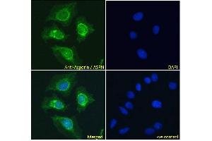 ABIN185364 Immunofluorescence analysis of paraformaldehyde fixed HeLa cells, permeabilized with 0. (Asporin 抗体  (Internal Region))