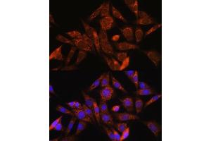 Immunofluorescence analysis of NIH/3T3 cells using ANG Rabbit pAb (ABIN6131230, ABIN6136869, ABIN6136870 and ABIN6217474) at dilution of 1:100. (ANG 抗体  (AA 25-147))