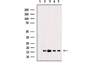 Western Blotting (WB) image for anti-Peripheral-Type Benzodiazepine Receptor (TSPO) (C-Term) antibody (ABIN6265775)