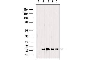 Western blot analysis of extracts from various samples, using TSPO Antibody. (TSPO 抗体  (C-Term))