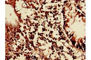 Immunohistochemistry of paraffin-embedded human appendix tissue using ABIN7158291 at dilution of 1:100 (LAIR1 抗体  (AA 22-165))