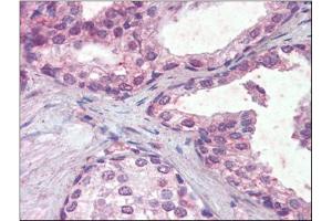 Human Prostate (formalin-fixed, paraffin-embedded) stained with IFNAR2followed by biotinylated anti-goat IgG secondary antibody, alkaline phosphatase-streptavidin and chromogen. (IFNAR2 抗体  (Internal Region))