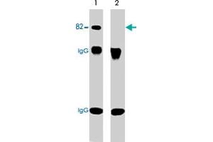 Western blot analysis of immunoprecipitates from neonatal rat brain lysate using anti-PRKCA antibody. (PKC alpha 抗体  (pSer657, pTyr658))