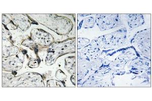 Immunohistochemistry analysis of paraffin-embedded human placenta tissue using PAK1/2 (epitope around residue 199) antibody. (PAK1/2 抗体  (Ser199))