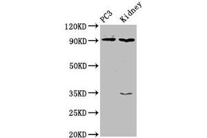 Western Blot Positive WB detected in: PC-3 whole cell lysate, Rat kidney tissue All lanes: CDK11A antibody at 4 μg/mL Secondary Goat polyclonal to rabbit IgG at 1/50000 dilution Predicted band size: 92, 91, 46, 19, 63, 50 kDa Observed band size: 92 kDa (Cyclin-Dependent Kinase 11A (CDK11A) (AA 5-216) 抗体)