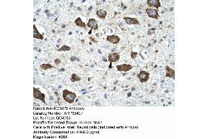 Human Brain (KCNIP2 抗体  (N-Term))