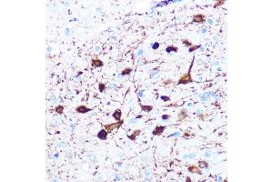 Immunohistochemistry of paraffin-embedded rat brain using gamma-Synuclein Rabbit mAb (ABIN3016563, ABIN3016564, ABIN1680688 and ABIN1680689) at dilution of 1:100 (40x lens). (SNCG 抗体)